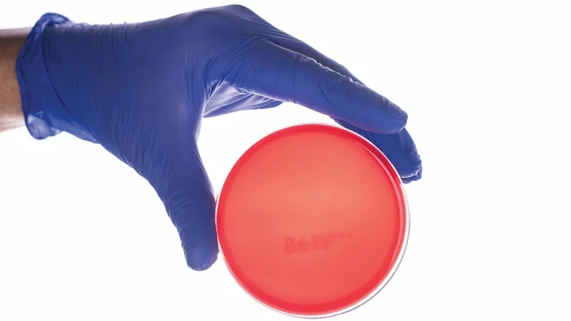 Contact plates and sterile swabs used for surface monitoring in a pharmaceutical microbiology laboratory.