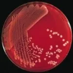 Microbial Limit Test in Pharmaceuticals using culture media and microbial enumeration