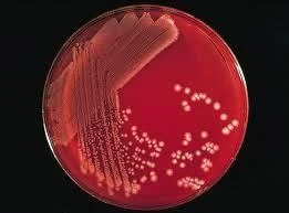 Microbial Limit Test in Pharmaceuticals using culture media and microbial enumeration